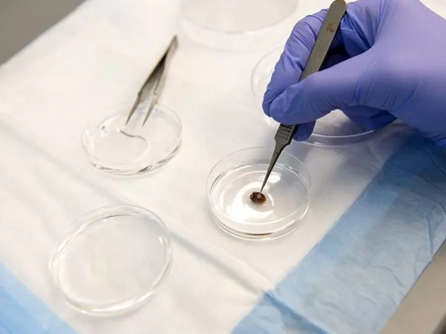 3D-nyomtatású tapasz a szívroham utáni felépüléshez