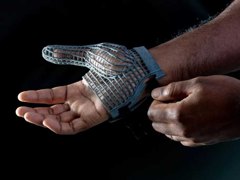 3D-nyomtatású, rácsos szerkezetű védőkesztyű
