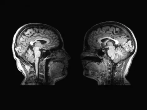 Kétszemélyes MRI a társas érintkezés kutatásához