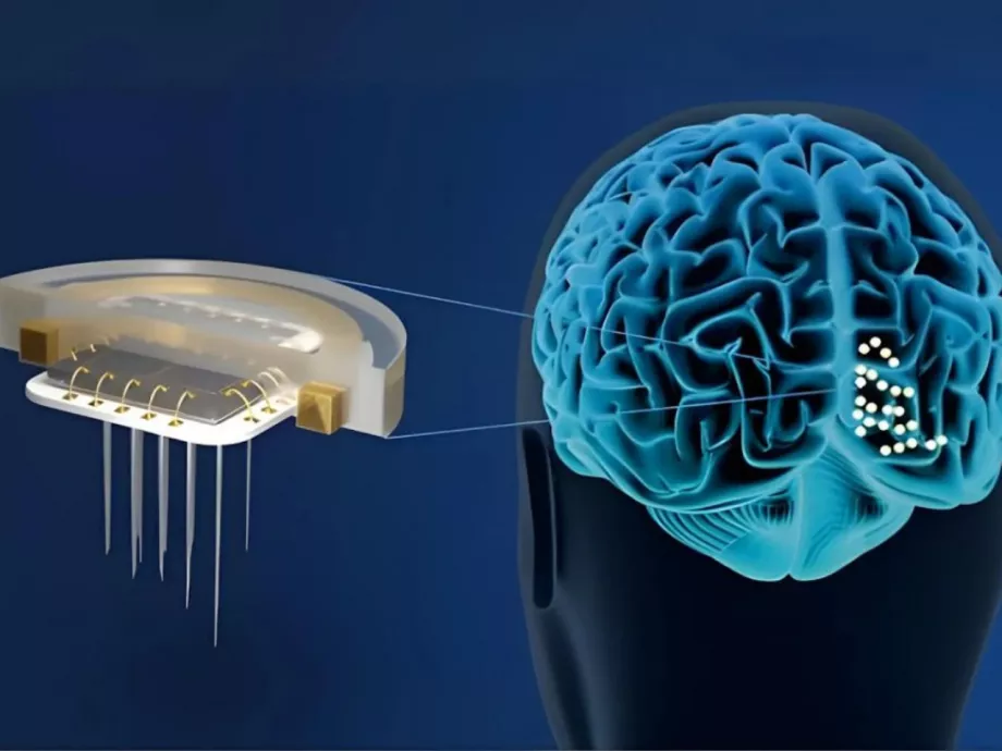 Agyi implantátummal lát a születése óra látássérült férfi