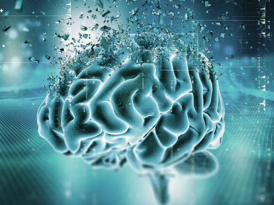 Európai klinikai kutatás indul az Alzheimer-kór korai felismerésére